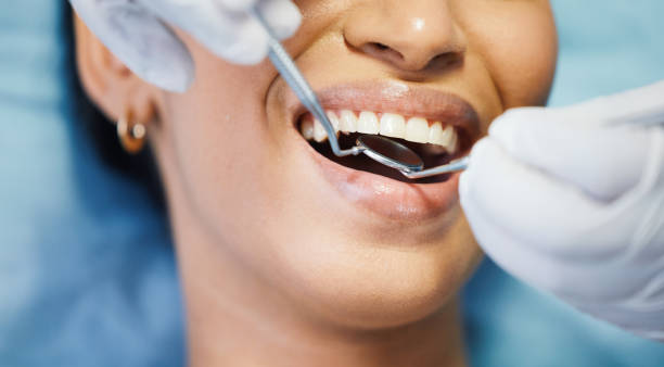 Best Emergency Treatment for Oral Infections in Louisville, GA